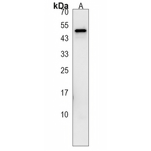 SHCA Rabbit Polyclonal Antibody