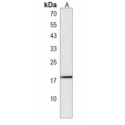 MYL12B Rabbit Polyclonal Antibody