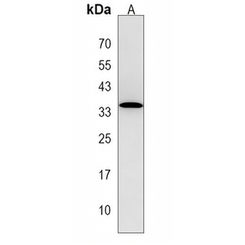 OR6S1 Rabbit Polyclonal Antibody