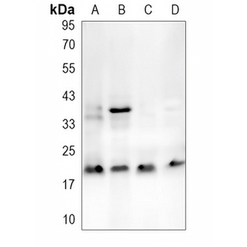 DAPL1 Rabbit Polyclonal Antibody