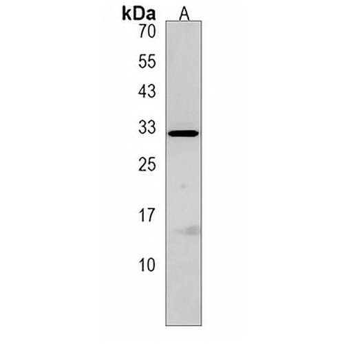 ELOVL3 Rabbit Polyclonal Antibody