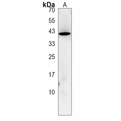 LRRC19 Rabbit Polyclonal Antibody