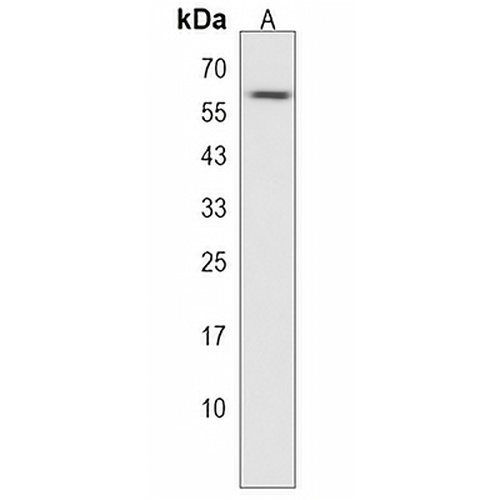 ZNF394 Rabbit Polyclonal Antibody