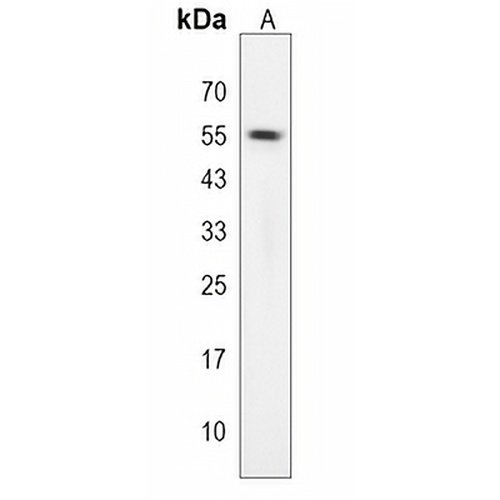 TES Rabbit Polyclonal Antibody