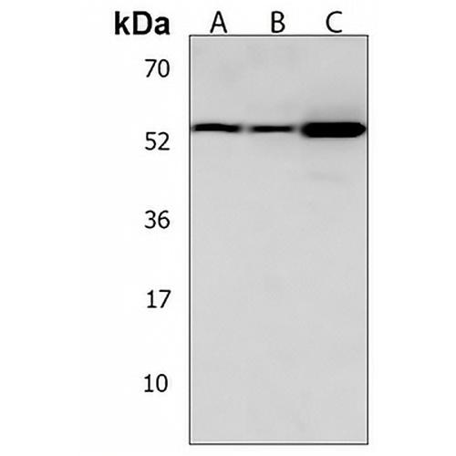 DMRTA2 Rabbit Polyclonal Antibody