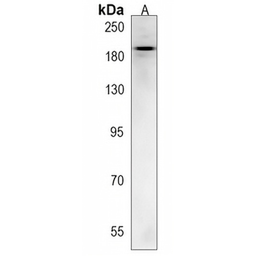 TTBK1 Rabbit Polyclonal Antibody