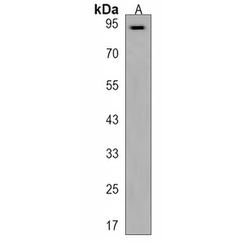 PDE8B Rabbit Polyclonal Antibody