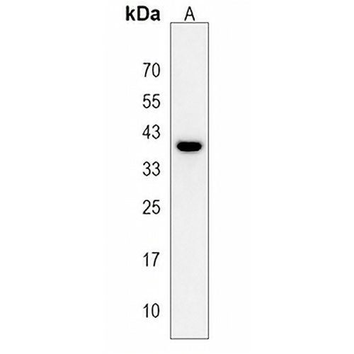 Ephrin B1 Rabbit Polyclonal Antibody