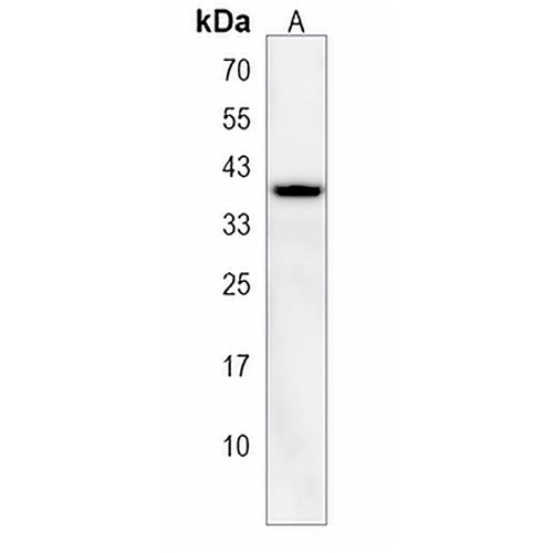 RALYL Rabbit Polyclonal Antibody