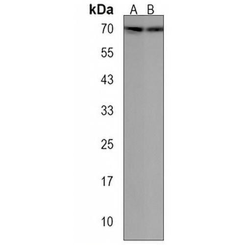 PIGB Rabbit Polyclonal Antibody