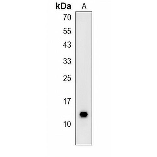 SH3BGRL1 Rabbit Polyclonal Antibody