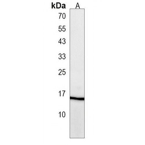 FUNDC2 Rabbit Polyclonal Antibody