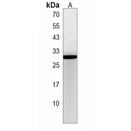 RGS2 Rabbit Polyclonal Antibody