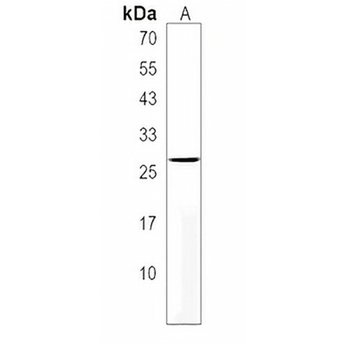 IPP2 Rabbit Polyclonal Antibody