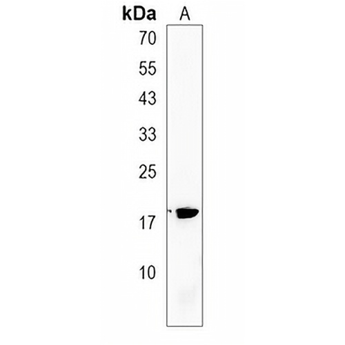 SPANXB Rabbit Polyclonal Antibody