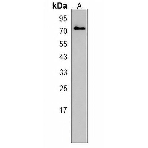 MEX3C Rabbit Polyclonal Antibody