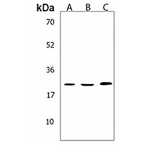 TMEM199 Rabbit Polyclonal Antibody