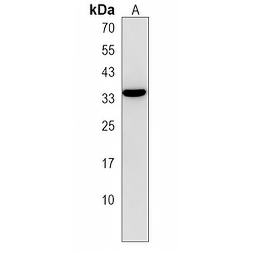 FAM26F Rabbit Polyclonal Antibody
