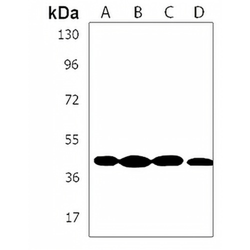 MECR Rabbit Polyclonal Antibody