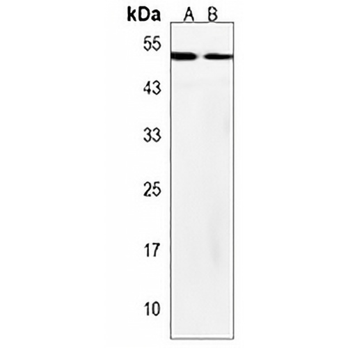 OXCT2 Rabbit Polyclonal Antibody