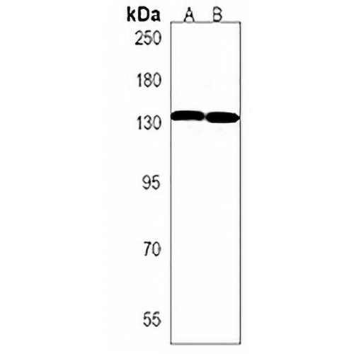 ANKS1A Rabbit Polyclonal Antibody