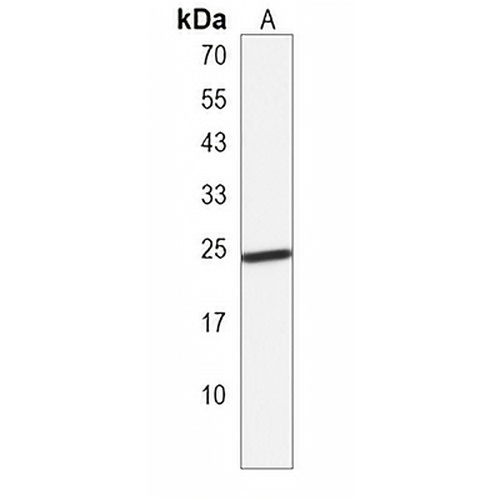 GINS3 Rabbit Polyclonal Antibody