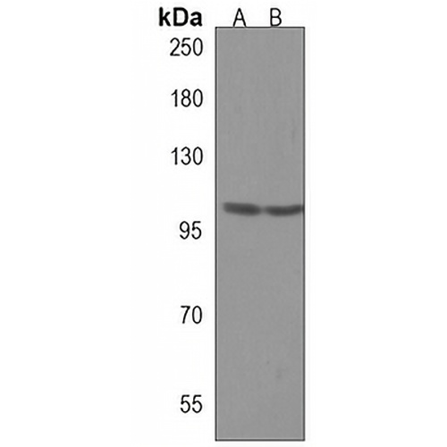 MORC3 Rabbit Polyclonal Antibody