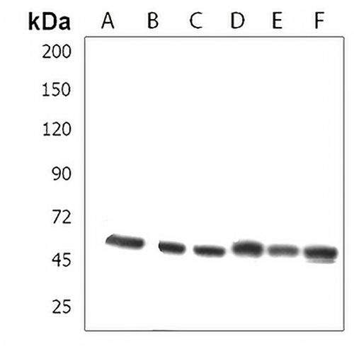 ZRSR2 Rabbit Polyclonal Antibody