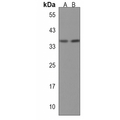 RPLP0P6 Rabbit Polyclonal Antibody