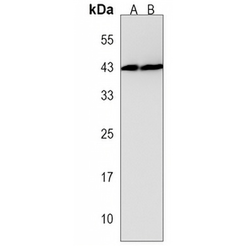 SIRPB1 Rabbit Polyclonal Antibody