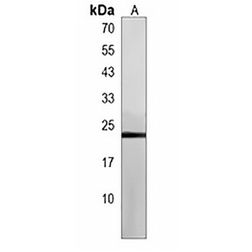 BLOC1S4 Rabbit Polyclonal Antibody