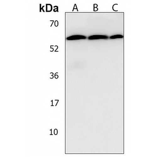 TRIM6 Rabbit Polyclonal Antibody