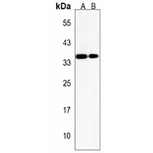 ASB9 Rabbit Polyclonal Antibody
