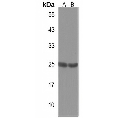 RAB3C Rabbit Polyclonal Antibody