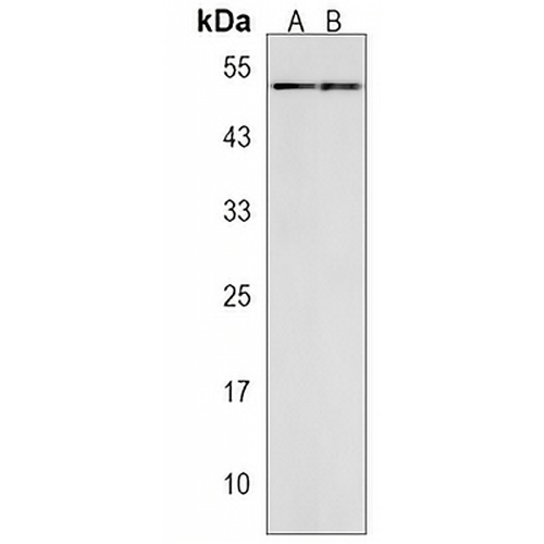 SLC25A25 Rabbit Polyclonal Antibody