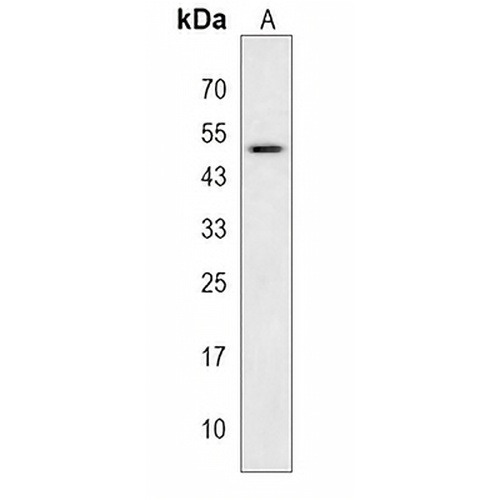 GPR164 Rabbit Polyclonal Antibody