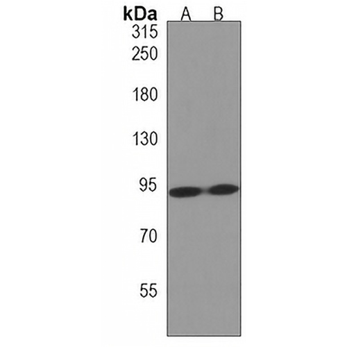 ZNF560 Rabbit Polyclonal Antibody