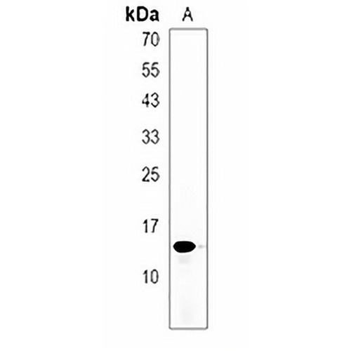 POLR2J3 Rabbit Polyclonal Antibody