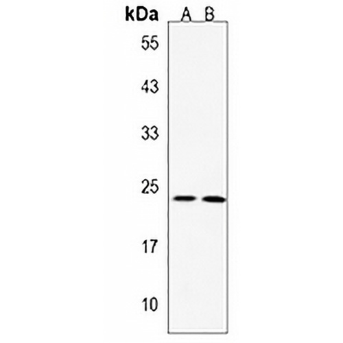 MMAB Rabbit Polyclonal Antibody