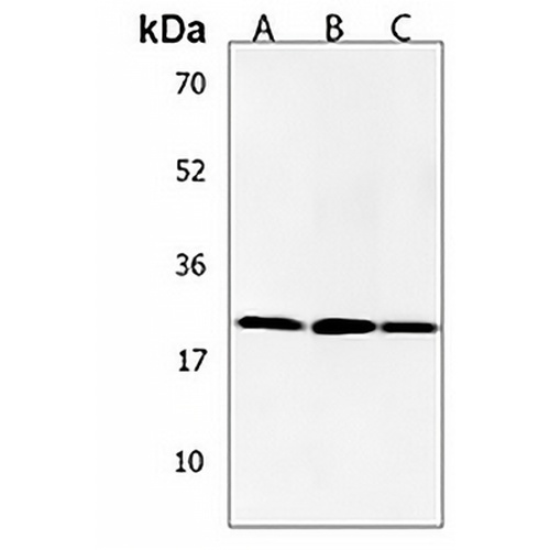 ANP32E Rabbit Polyclonal Antibody