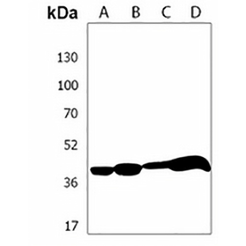HLA-B Rabbit Polyclonal Antibody