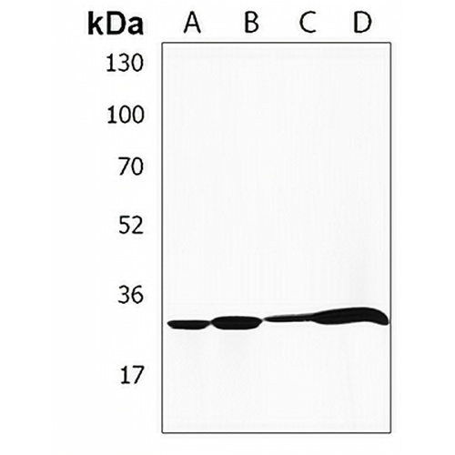 HLA-DRB1 Rabbit Polyclonal Antibody