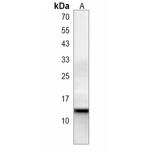 HBG2 Rabbit Polyclonal Antibody