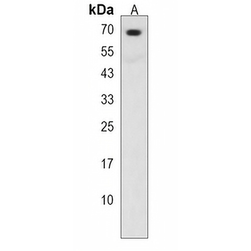 SMARCD3 Rabbit Polyclonal Antibody