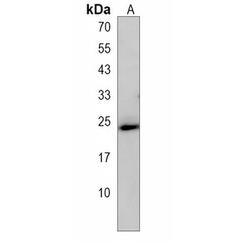 TMEM239 Rabbit Polyclonal Antibody