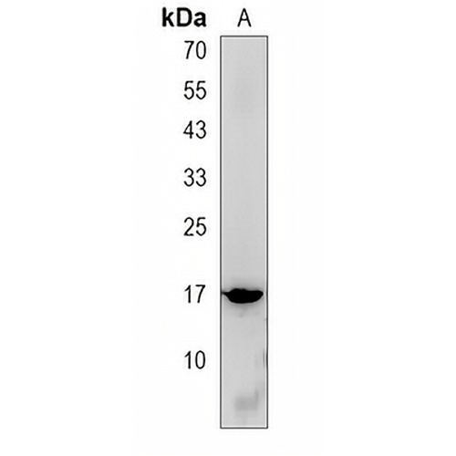 SPANXA1 Rabbit Polyclonal Antibody