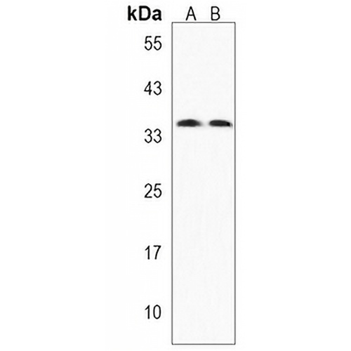 KCTD4 Rabbit Polyclonal Antibody
