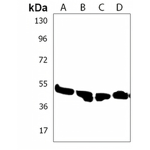 ZDHHC11 Rabbit Polyclonal Antibody