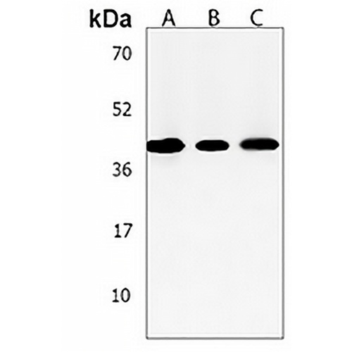ACADSB Rabbit Polyclonal Antibody