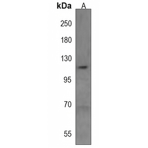 ANKRD24 Rabbit Polyclonal Antibody